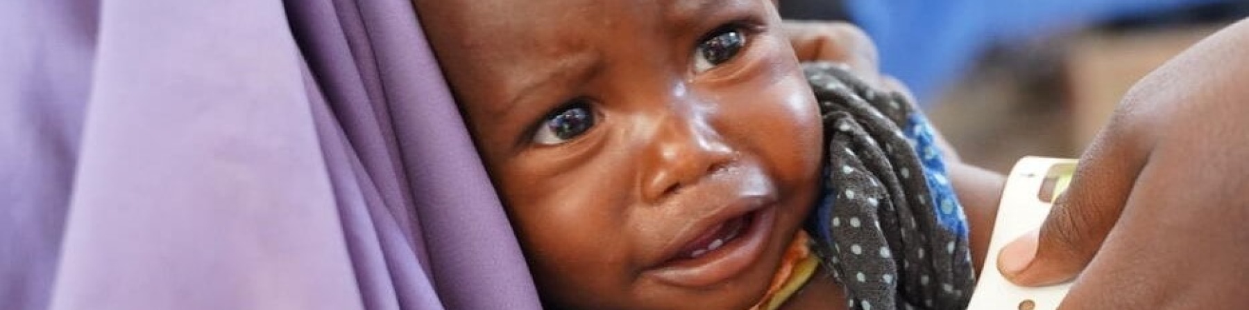 bambina che piange mentre è in braccio e le misurano il livello di malnutrizione con il braccialetto muac