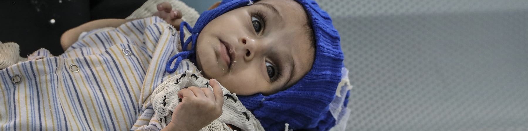 Primo piano di un bambino yemenita di 11 mesi sdraiato sulle gambe della mamma, guarda in alto e indossa un cappello di lana blu e un abitino bianco a righe.