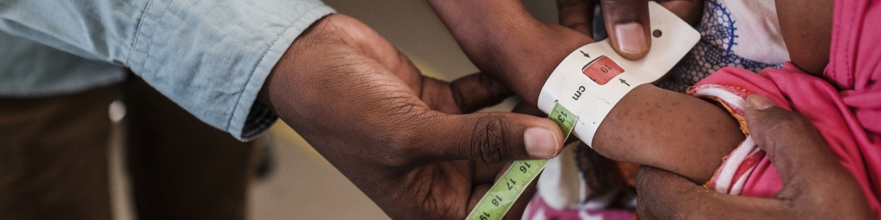 dettaglio sulle mani di un medico che prende la circonferenza del braccio di un bambino malnutrito