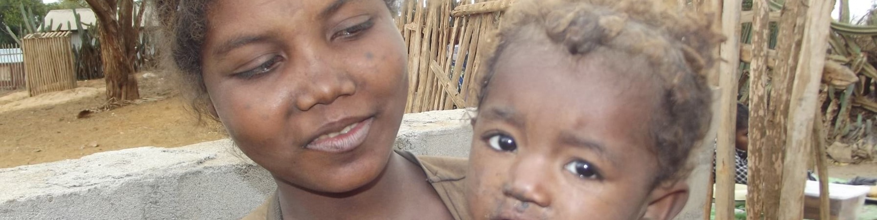 una mamma del Madagascar tiene in bracco sua figlia. La madre indossa una maglietta marrone, la bambina un vestito rosa. La piccola ha u braccio appoggiato al petto della madre e guarda in camera grata verso l obiettivo, la madre guarda la bambina.