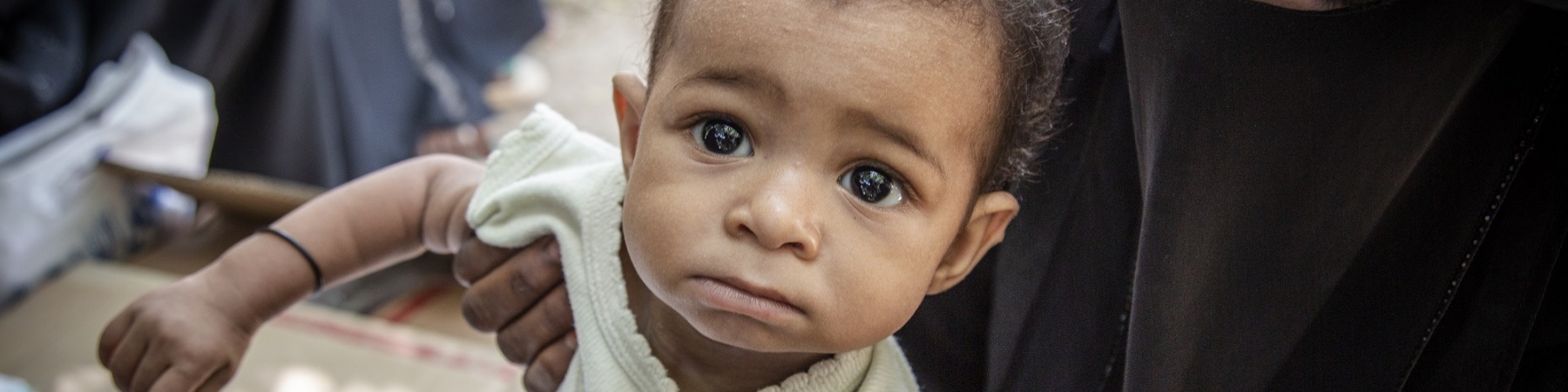 Bimbo yemenita sottoposto al test per la malnutrizione in braccio alla mamma