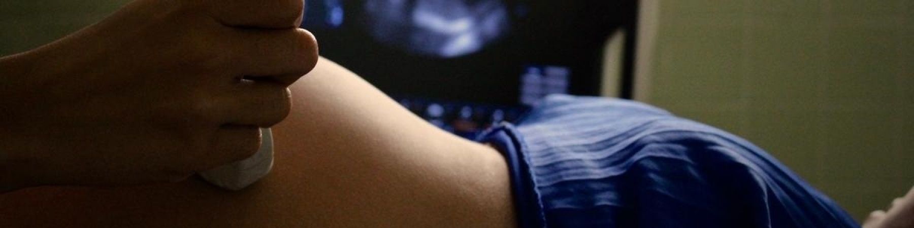 primo piano del pancione di una donna incinta mentre fa un ecografia