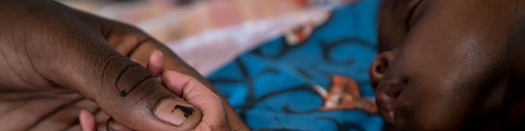 Bambino nigeriano affetto da malnutrizione acuta grave che dorme mentre una mano tiene teneramente la sua manina