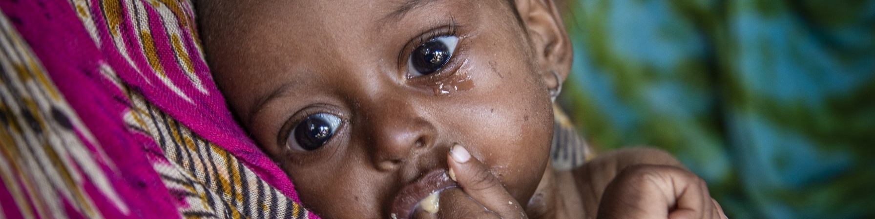 Malnutrizione Muna bambina yemen con mano in bocca