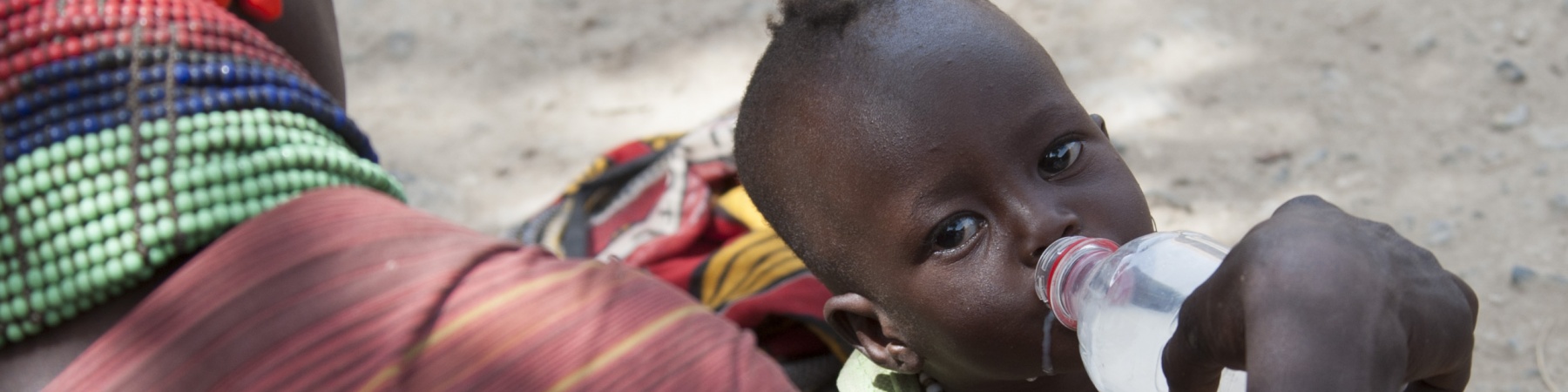 Bambini malnutriti in Kenya a causa della siccità
