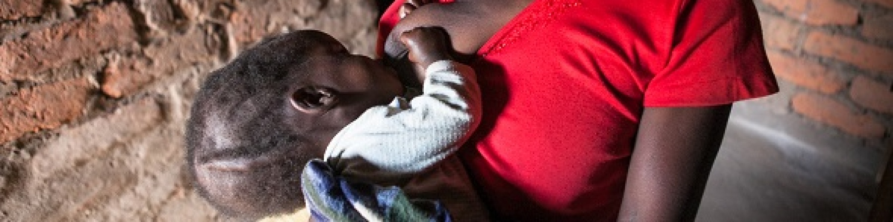 La malnutrizione in contesti difficili: la storia della bambina di Lidia