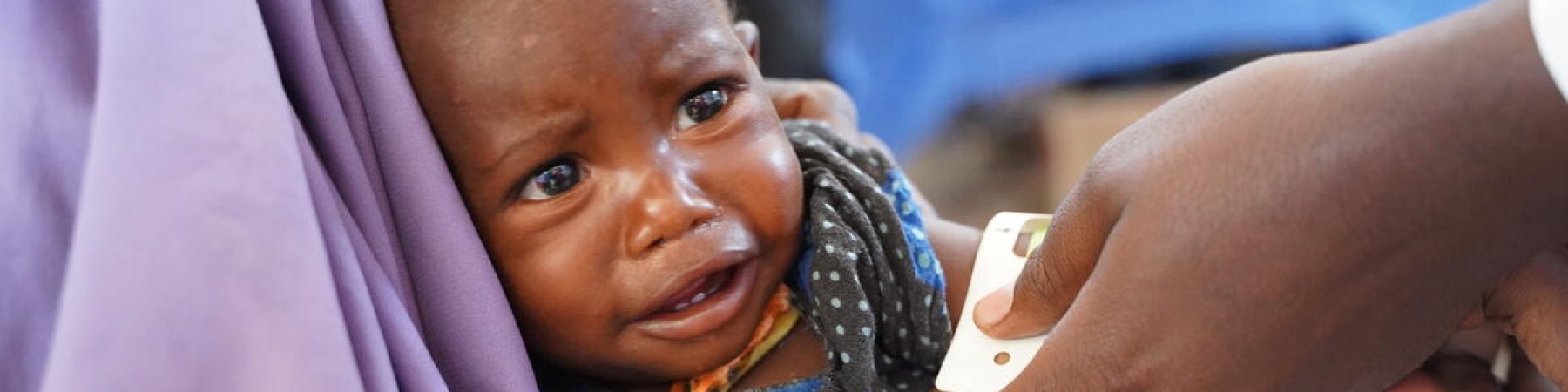 bambina in braccio che piange mentre le misurano il livello di malnutrizione con il brsaccialetto MUAC