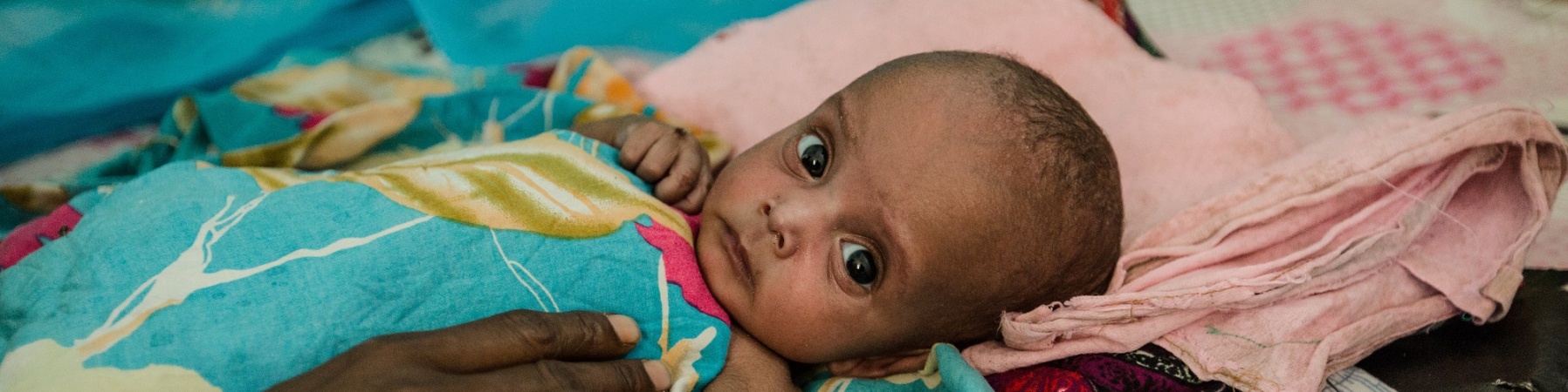Un bambino malnutrito è così debole da non riuscire ad alzarsi.