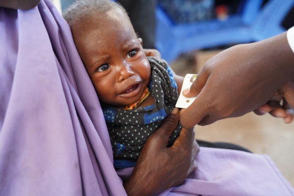 bambino che piange mentre viene misurato il suo livello di malnutrizione tramite braccialetto muac