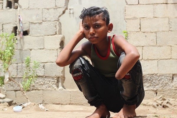 Un bambino yemenita con una menomazione al braccio guarda in camere