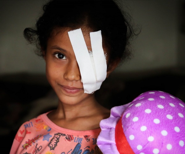 Razan, una bambina yemenita ferita all'occhio e curata da Save the Children