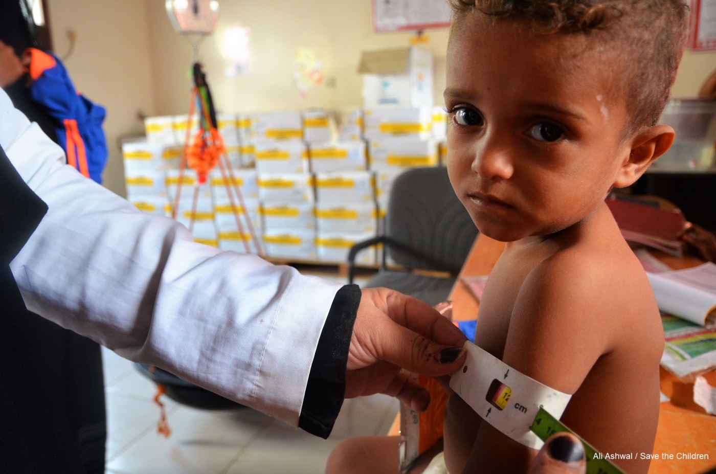 In Yemen 46 Mila Bambini Rischiano Di Morire Per Malnutrizione Entro L Anno Save The Children Italia