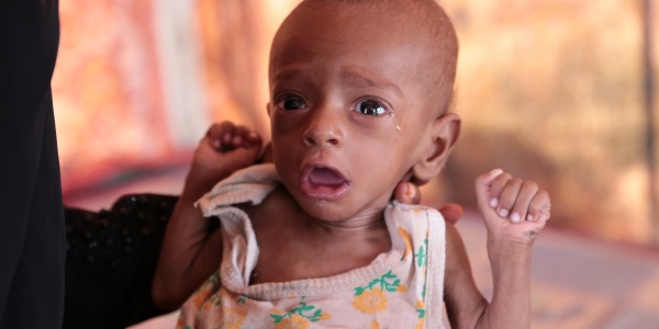 Crisi alimentare Yemen Crisi alimentare Yemen