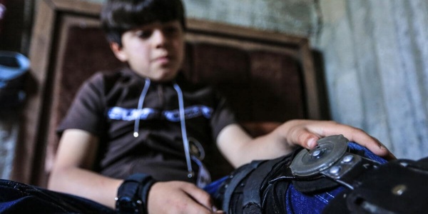 Bambino palestinese con ferita alla gamba dopo lo scoppio di una bomba
