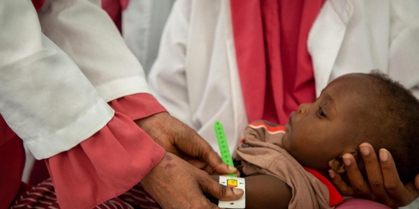 bambino sorretto da due operatrici mentre una gli misura il livello di malnutrizione con un braccialetto muac