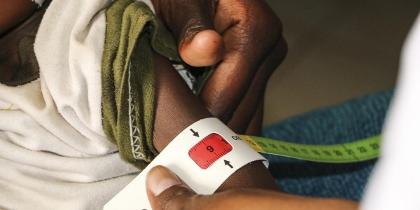 Braccio magro di un bambino etiope con attorno il braccialetto MUAC per misurare la sua grave malnutrizione
