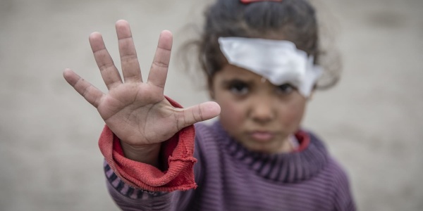 Bambina con un cerotto sull occhio sinistro fa un gesto di "stop" con la sua mano