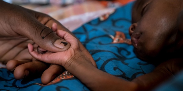 Bambino nigeriano affetto da malnutrizione acuta grave che dorme mentre una mano tiene teneramente la sua manina