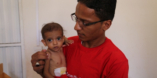 Bambino yemenita malnutrito in braccio a operatore Save the Children