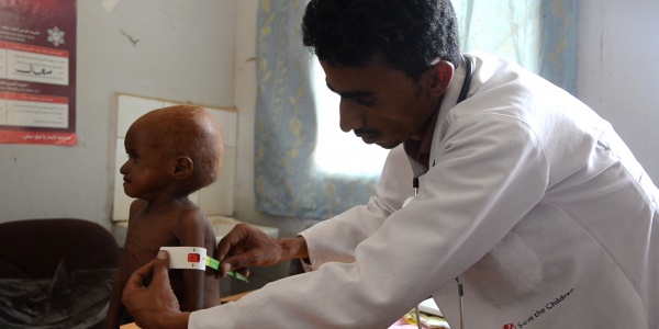 malnutrizione in yemen