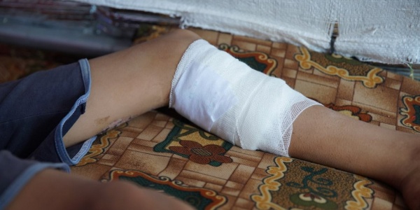 gamba-ferita-bambino-siriano