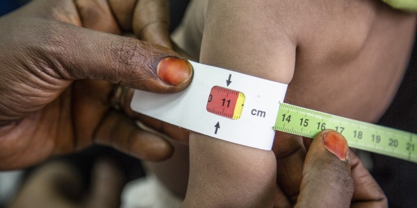 Primo piano delle mani di una donna che misurano il braccio di un bambino malnutrito